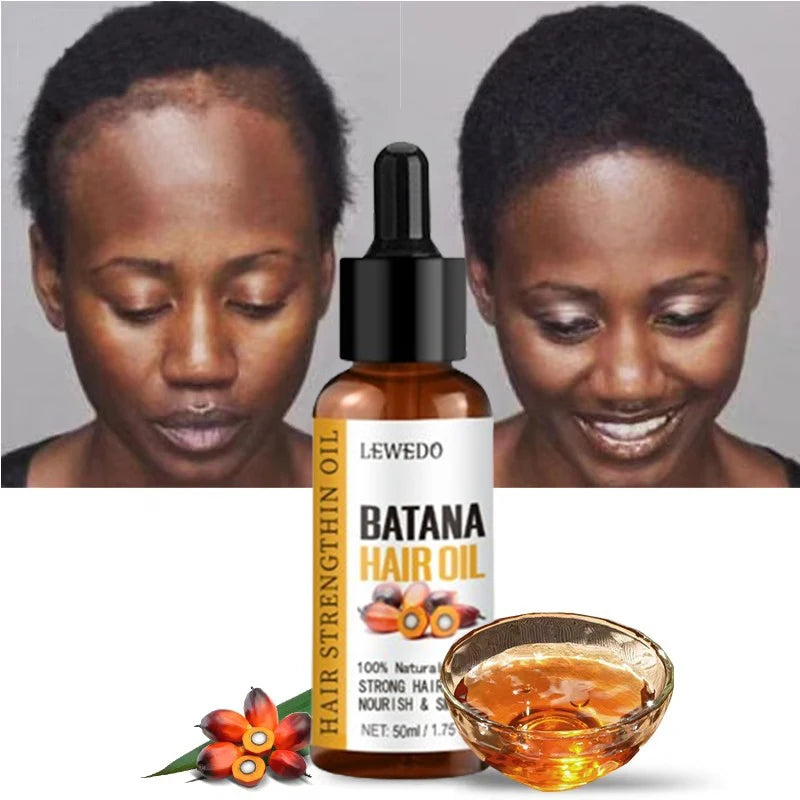 Lewedo Naturals Batana Oil Fast Hair Growth for Men Women Pure Batana Oil